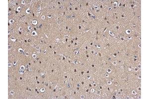 IHC-P Image MAD2L1 antibody [C2C3], C-term detects MAD2L1 protein at nucleus on rat fore brain by immunohistochemical analysis. (MAD2L1 anticorps  (C-Term))