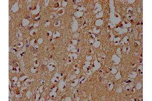 IHC image of ABIN7139719 diluted at 1:100 and staining in paraffin-embedded human brain tissue performed on a Leica BondTM system. (SNCA anticorps  (AA 119-136))
