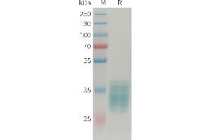 Human APLN Protein, hFc Tag on SDS-PAGE under reducing condition.