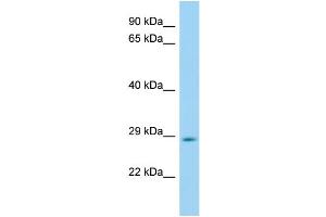 WB Suggested Anti-Hes6 Antibody Titration: 1. (HES6 anticorps  (Middle Region))