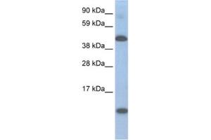 Western Blotting (WB) image for anti-Ligand Dependent Nuclear Receptor Corepressor (Lcor) antibody (ABIN2461545) (Lcor anticorps)