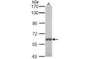 WB Image Sample (30 ug of whole cell lysate) A: NT2D1 7.