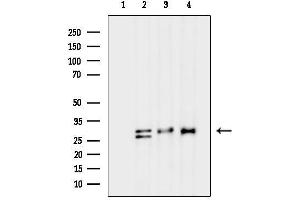 anti-Dpy-30 Homolog (DPY30) antibody