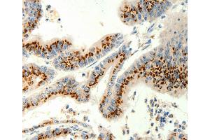 Immunohistochemistry (IHC) image for anti-Transient Receptor Potential Cation Channel, Subfamily C, Member 6 (TRPC6) antibody (ABIN2426989) (TRPC6 anticorps)
