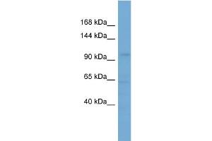 WB Suggested Anti-SLCO5A1 Antibody Titration: 0. (SLCO5A1 anticorps  (Middle Region))