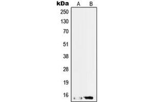 Western blot analysis of SAP14 expression in HepG2 (A), RT4 (B) whole cell lysates. (Pre-mRNA Branch Site Protein p14 (SF3B14) (C-Term) anticorps)