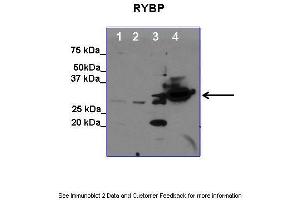 Lanes:   1. (RYBP anticorps  (C-Term))