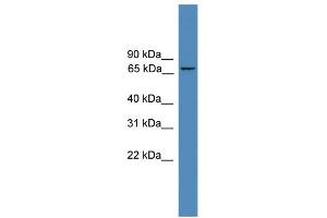 WB Suggested Anti-ZNF304 Antibody Titration: 0. (ZNF304 anticorps  (N-Term))