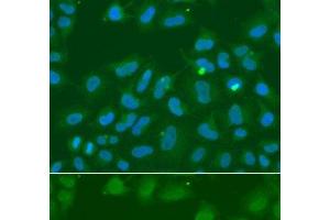 Immunofluorescence analysis of A549 cells using ORC6 Polyclonal Antibody
