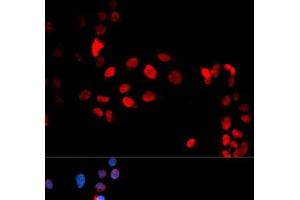 Immunofluorescence analysis of U2OS cells using Phospho-MAX(S11) Polyclonal Antibody (MAX anticorps  (pSer11))