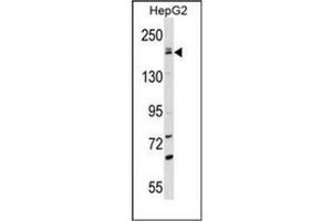 Western blot analysis of NTE Antibody (C-term) in HepG2 cell line lysates (35ug/lane). (PNPLA6 anticorps  (C-Term))