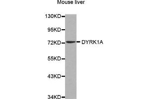Western Blotting (WB) image for anti-Dual-Specificity tyrosine-(Y)-phosphorylation Regulated Kinase 1A (DYRK1A) (AA 624-763) antibody (ABIN6213900) (DYRK1A anticorps  (AA 624-763))