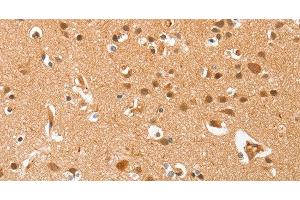 Immunohistochemistry of paraffin-embedded Human brain using AHSG Polyclonal Antibody at dilution of 1:60