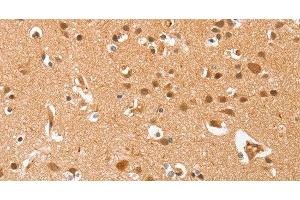 Immunohistochemistry of paraffin-embedded Human brain using AHSG Polyclonal Antibody at dilution of 1:60 (Fetuin A anticorps)