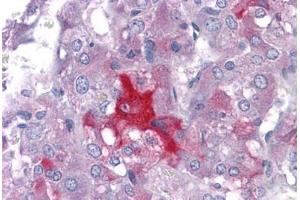 Human Adrena: Formalin-Fixed, Paraffin-Embedded (FFPE) (LMTK2 anticorps  (AA 1181-1280))