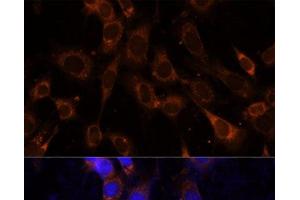 Immunofluorescence analysis of NIH-3T3 cells using VPS25 Polyclonal Antibody at dilution of 1:100 (40x lens).