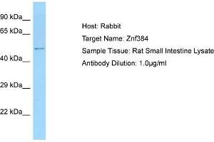 Host: Rabbit Target Name: ZNF384 Sample Tissue: Rat Small Intestine Antibody Dilution: 1ug/ml (ZNF384 anticorps  (N-Term))