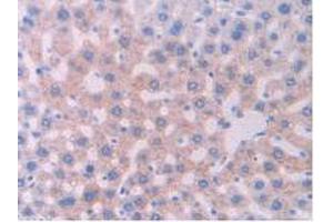 IHC-P analysis of Rat Liver Tissue, with DAB staining. (CYP1A1 anticorps  (AA 251-521))