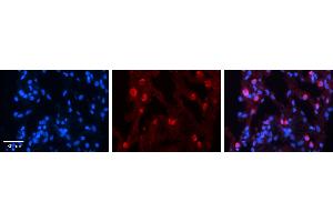 Immunohistochemistry (IHC) image for anti-Sulfotransferase Family, Cytosolic, 1A, Phenol-Preferring, Member 1 (SULT1A1) (N-Term) antibody (ABIN2783656)
