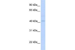 WB Suggested Anti-GSDML Antibody Titration:  0.