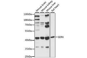 Western blot analysis of extracts of various cell lines, using SDF4 antibody (ABIN6290972) at 1:1000 dilution. (SDF4 anticorps)