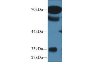Western blot analysis of Human Serum, using Human OS9 Antibody (1 µg/ml) and HRP-conjugated Goat Anti-Rabbit antibody ( (OS9 anticorps  (AA 466-667))