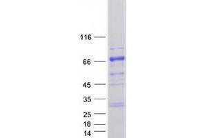 Validation with Western Blot