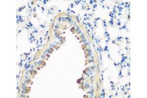 Immunohistochemistry of paraffin-embedded Mouse lung using CAV3 Polyclonal Antibody at dilution of 1:200 (40x lens). (Caveolin 3 anticorps)