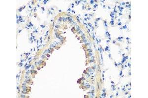 Immunohistochemistry of paraffin-embedded Mouse lung using CAV3 Polyclonal Antibody at dilution of 1:200 (40x lens).