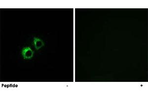 Immunofluorescence analysis of MCF-7 cells, using MRPS21 polyclonal antibody . (MRPS21 anticorps)