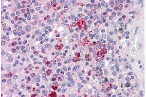 Human Spleen: Formalin-Fixed, Paraffin-Embedded (FFPE) (CCT2 anticorps  (AA 277-473))