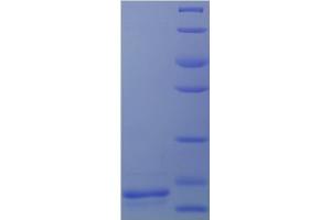SDS-PAGE (SDS) image for Transforming Growth Factor, beta 1 (TGFB1) (AA 279-390), (partial) protein (His tag) (ABIN5710482)
