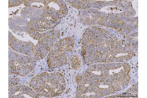 IHC analysis of BI-1/TMBIM6 using anti-BI-1/TMBIM6 antibody (ABIN7603199).