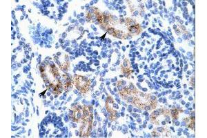 Image no. 1 for anti-Activating Transcription Factor 2 (ATF2) (AA 401-450) antibody (ABIN202679)