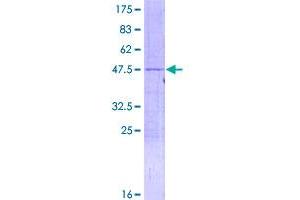 Image no. 1 for Ribosomal Protein L18a (RPL18A) (AA 1-176) protein (GST tag) (ABIN1318561)