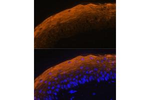 Immunofluorescence analysis of mouse skin using SPRR1A antibody (ABIN7270369) at dilution of 1:100. (SPRR1A anticorps)