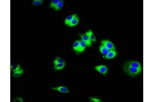 Immunofluorescence staining of HepG2 cells with ABIN7170259 at 1:100, counter-stained with DAPI. (SLC45A3 anticorps  (AA 408-487))