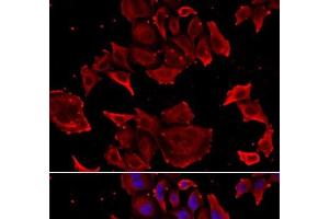Immunofluorescence analysis of HeLa cells using TCAP Polyclonal Antibody (TCAP anticorps)