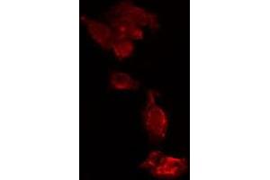 ABIN6275652 staining  HeLa cells by IF/ICC. (USP15 anticorps  (N-Term))