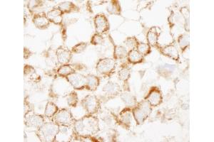 anti-Insulin Receptor Substrate 2 (IRS2) (AA 1288-1338) antibody
