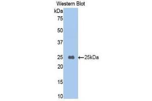 Western Blotting (WB) image for anti-Carboxypeptidase B2 (Plasma) (CPB2) (AA 187-327) antibody (ABIN1860680) (CPB2 anticorps  (AA 187-327))