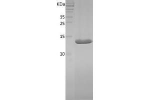 Western Blotting (WB) image for Peripheral Myelin Protein 2 (PMP2) (AA 2-132) protein (His tag) (ABIN7124357)
