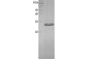 Western Blotting (WB) image for Peripheral Myelin Protein 2 (PMP2) (AA 2-132) protein (His tag) (ABIN7124357)