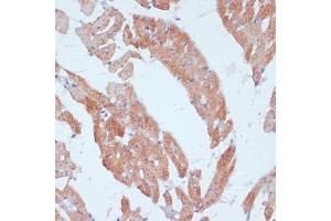 Immunohistochemistry of paraffin-embedded rat heart using  antibody (ABIN6129863, ABIN6136456, ABIN6136457 and ABIN6215371) at dilution of 1:100 (40x lens).