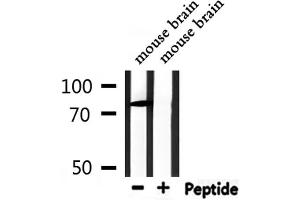 Western blot analysis of extracts from mouse brain, using CHFR Antibody. (CHFR anticorps)