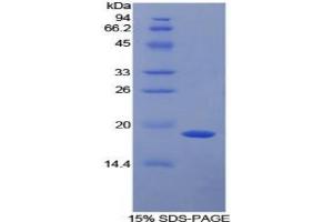 SDS-PAGE analysis of Mouse a2PI Protein. (alpha 2 Antiplasmin Protéine)