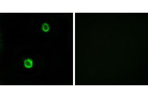 Peptide - +Immunohistochemistry analysis of paraffin-embedded human colon carcinoma tissue using CST1 antibody. (CST1 anticorps)