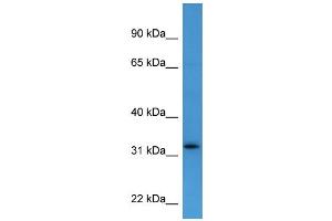Western Blotting (WB) image for anti-Docking Protein 4 (DOK4) (C-Term) antibody (ABIN2788378) (DOK4 anticorps  (C-Term))