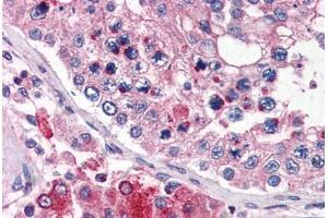 Human Testis (formalin-fixed, paraffin-embedded) stained with TMC6 antibody ABIN343905 at 5 ug/ml followed by biotinylated goat anti-rabbit IgG secondary antibody ABIN481713, alkaline phosphatase-streptavidin and chromogen. (TMC6 anticorps  (N-Term))