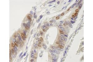 Immunohistochemistry (IHC) image for anti-Interferon Regulatory Factor 3 (IRF3) (AA 100-150) antibody (ABIN7448610) (IRF3 anticorps  (AA 100-150))